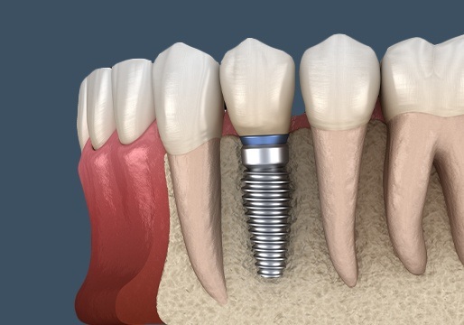 Animation of the supportive sturcutres below teeth